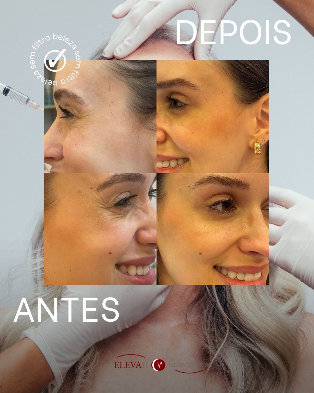 Foto antes e depois Dieisse