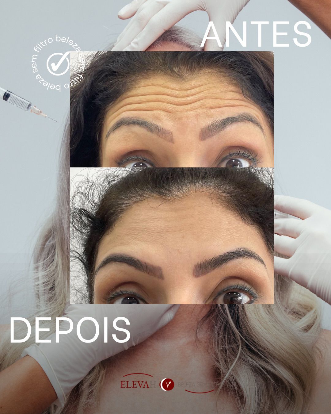 Foto antes e depois Dieisse